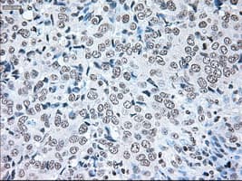 BRAF / B-Raf Antibody (clone OTI4C11)