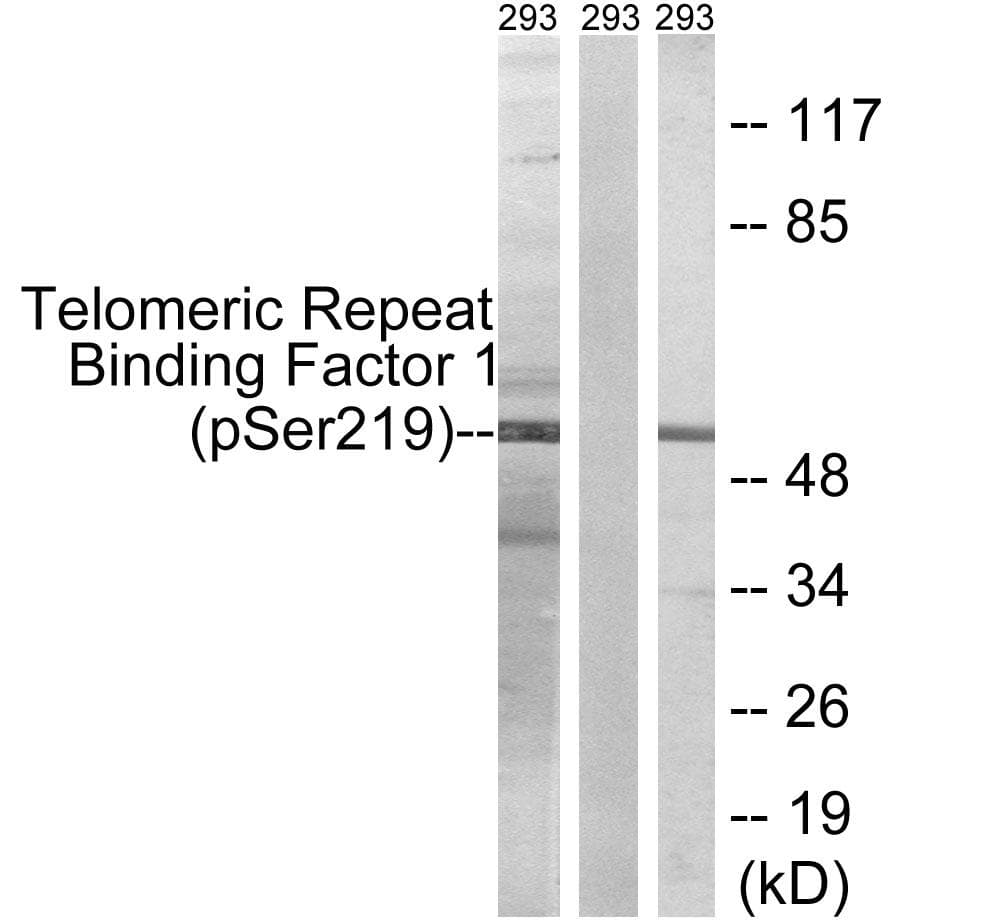 TRF1 / TERF1 Antibody (phospho-Ser219)