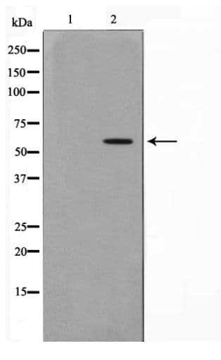 AKT1 Antibody (phospho-Ser473)
