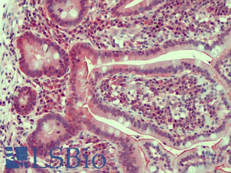 IHC-plus™ CLDN2 / Claudin 2 Antibody (aa135-164)