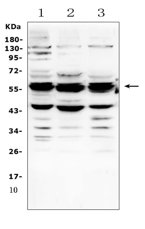 GALNS / Chondroitinase Antibody