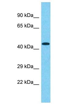 FAM47E Antibody (aa154-203)