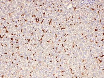 Polyclonal Rabbit anti-Human ABCC2 / MRP2 Antibody (IHC, WB)