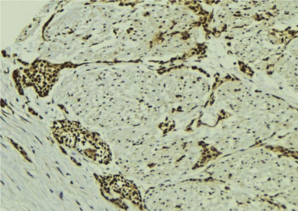 Polyclonal Rabbit anti-Human MAGOH Antibody (IHC, IF, WB)