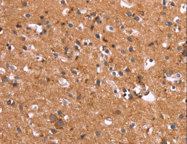 HSD17 / HSD17B1 Antibody
