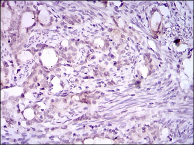 ITGA2B / CD41 Antibody (aa45-149, clone 2E10C9)