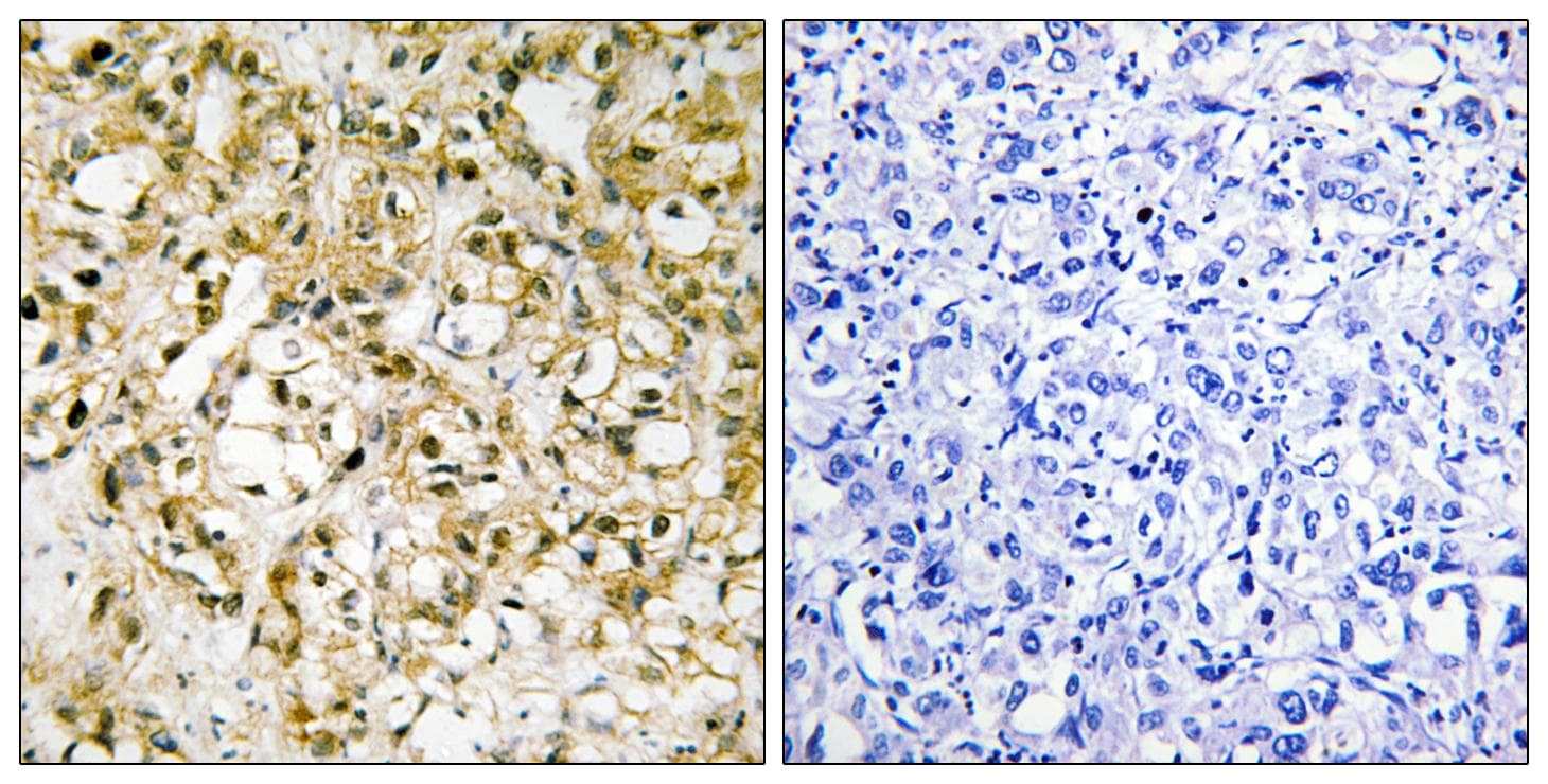MtTFA / TFAM Antibody