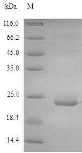 Mouse CLEC4E / MINCLE Protein (Recombinant 6His, N-terminus)