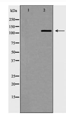 Polyclonal Rabbit anti-Human TERT / Telomerase Antibody (phospho-Ser824, WB)