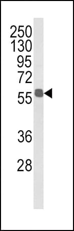 Polyclonal Rabbit anti-Human ALDH3B1 Antibody (aa334-360, IHC, WB)