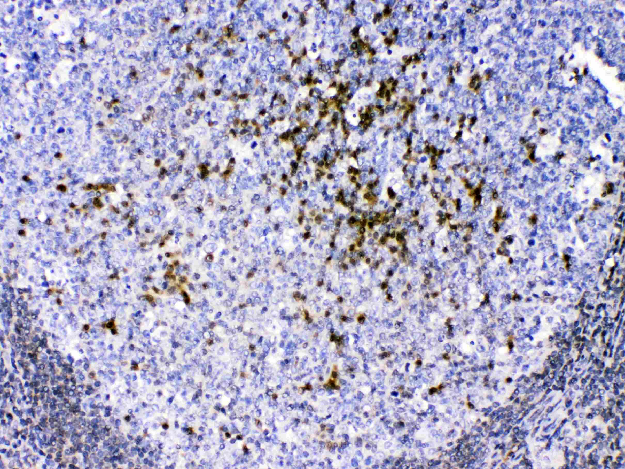 CCS Antibody