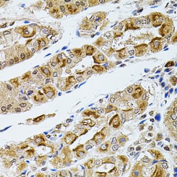 RPS6KA3 / RSK2 Antibody