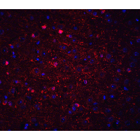Polyclonal Rabbit anti-Human Kinesin 5A / KIF5A Antibody (IHC, IF, WB)