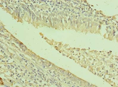Polyclonal Rabbit anti-Human TXNDC11 Antibody (IHC)