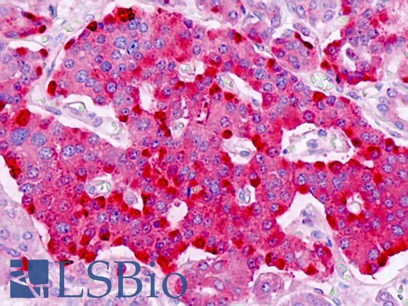 IHC-plus™ PTPRN2 / Phogrin Antibody (aa206-255)