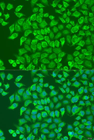CD79A / CD79 Alpha Antibody