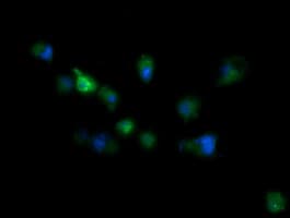 Monoclonal Mouse anti-Human RIOK2 Antibody (clone OTI3E11, IHC, IF, WB)