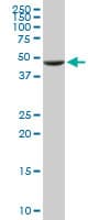 UGP2 Antibody (clone 3H3)