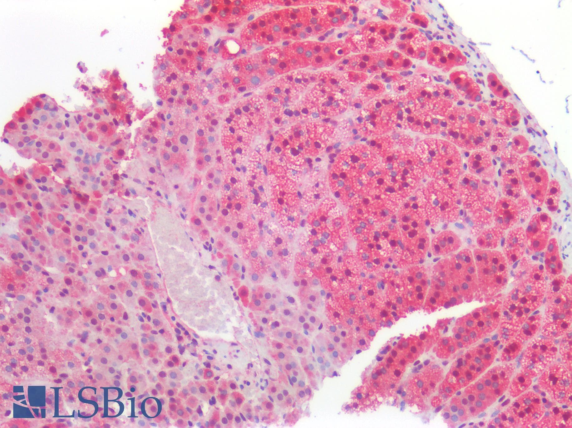 IHC-plus™ Polyclonal Rabbit anti-Human PARK7 / DJ-1 Antibody (IHC, IF, WB)
