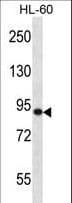 Polyclonal Rabbit anti-Human SP140 Antibody (aa272-301, IHC, IF, WB)
