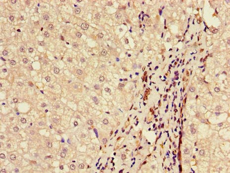 Polyclonal Rabbit anti-Human BAAT / BAT Antibody (IHC, IF)