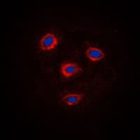 FZD8 / Frizzled 8 Antibody (C-Terminus)