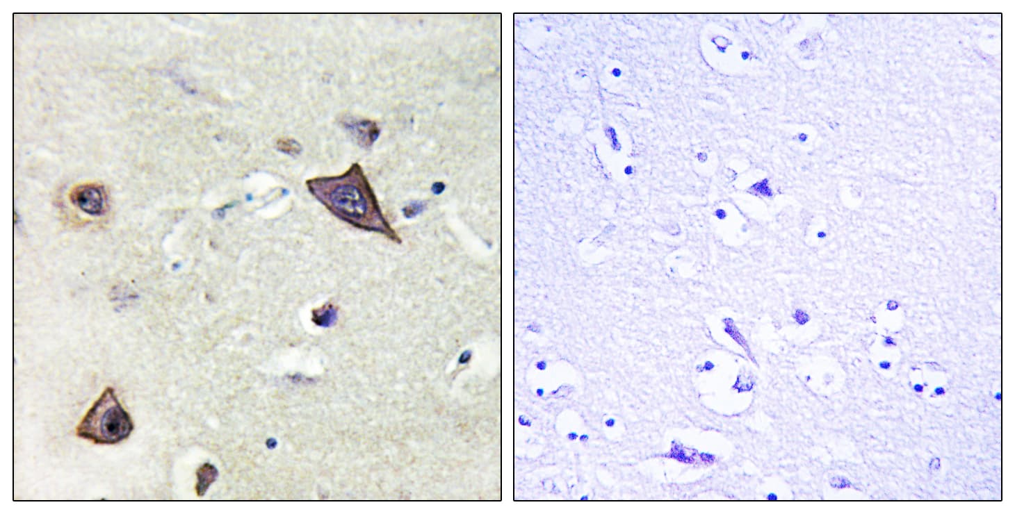 GRIN1 / NMDAR1 Antibody (aa862-911)