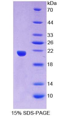 Human SNRPC / U1C Protein (Recombinant His-T7)