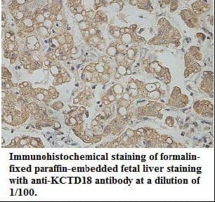 KCTD18 Antibody (aa90-287)