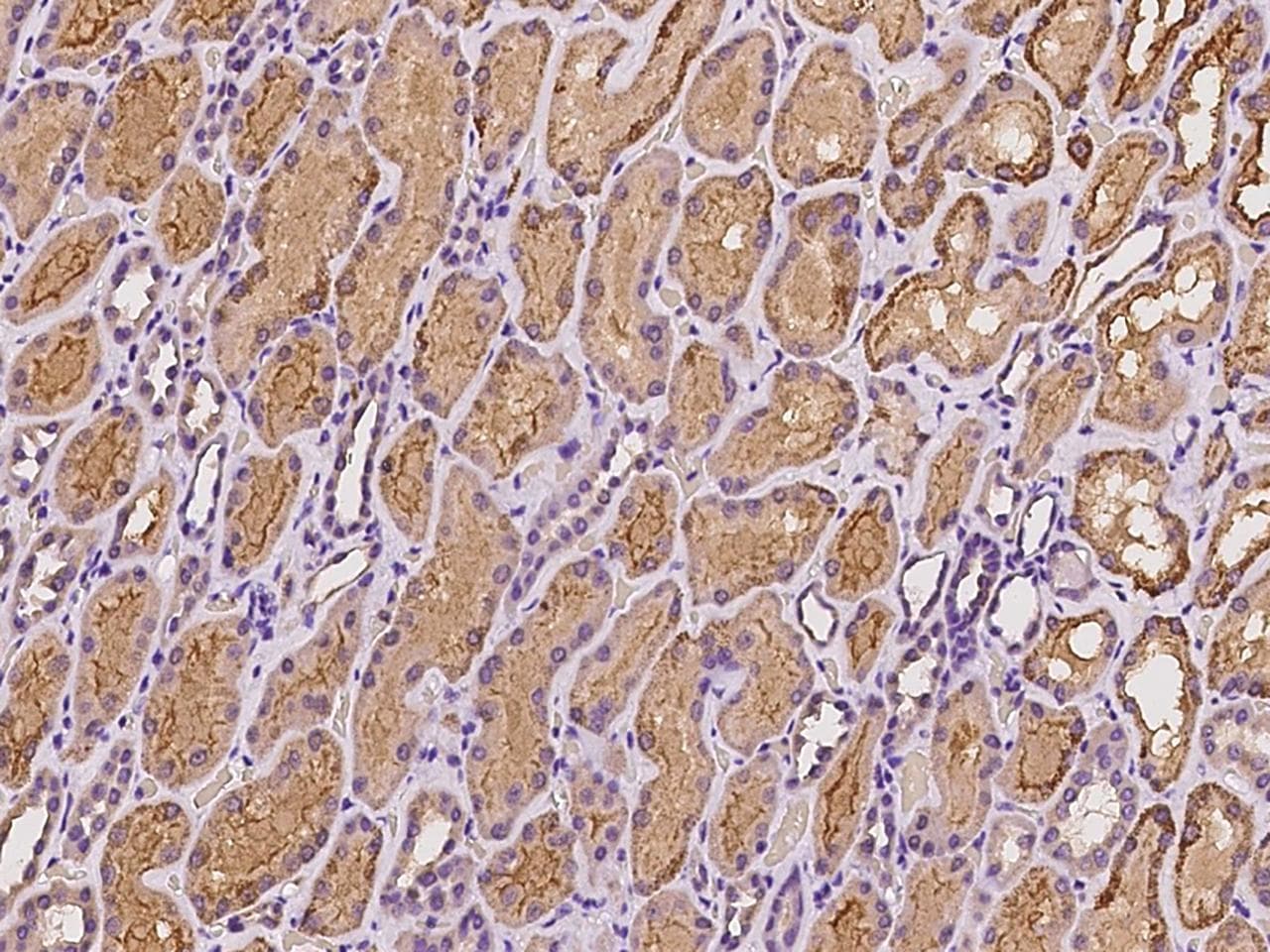 ARG2 / Arginase 2 Antibody