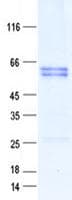 Human RNF115 / BCA2 Protein (Recombinant GST, N-terminus + His, C-terminus)