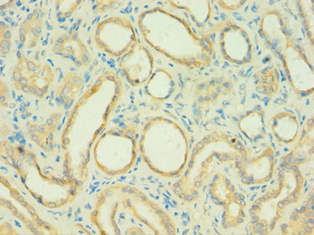C4BPB / C4BP Beta Antibody (aa18-252)