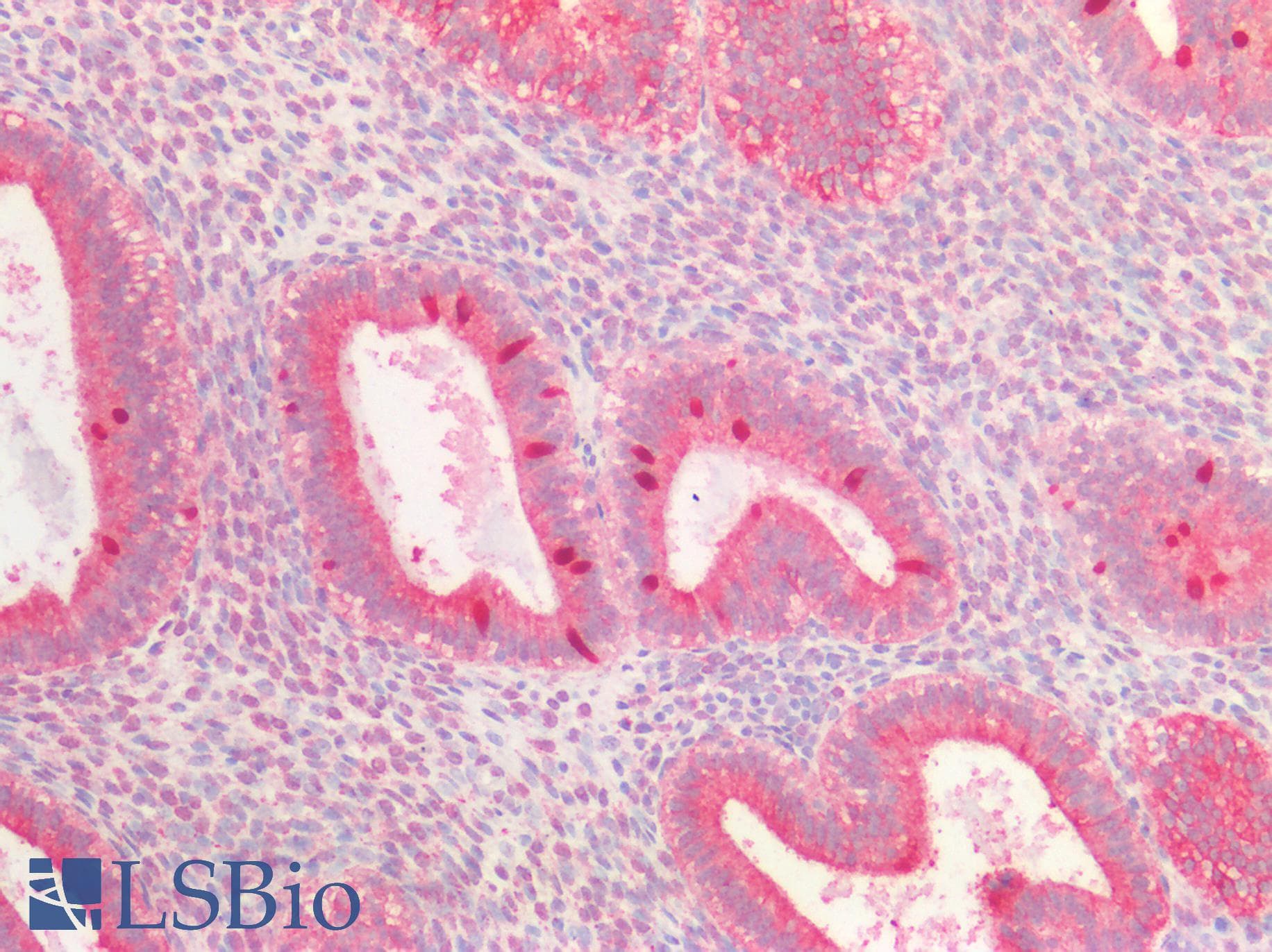 PathPlus™ P4HA1 Antibody (clone 4F1)