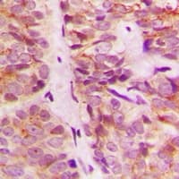 AK1 / Adenylate Kinase 1 Antibody