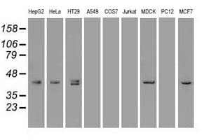 KRT19 / CK19 / Cytokeratin 19 Antibody (clone OTI5D1)