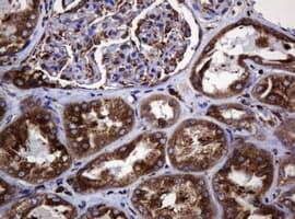 Monoclonal Mouse anti-Human POGK Antibody (clone OTI3E2, IHC, WB)