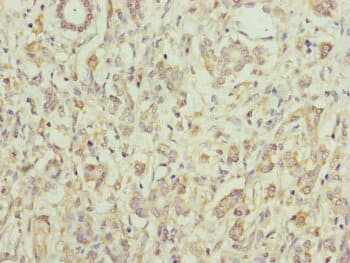 EIF3M / PCID1 Antibody