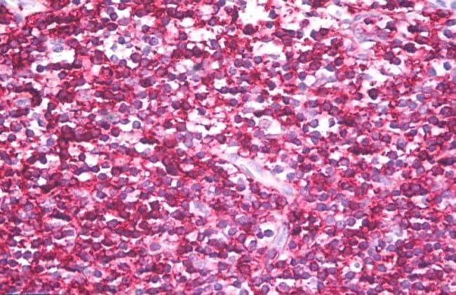 CD45RB Antibody (clone MEM-143)