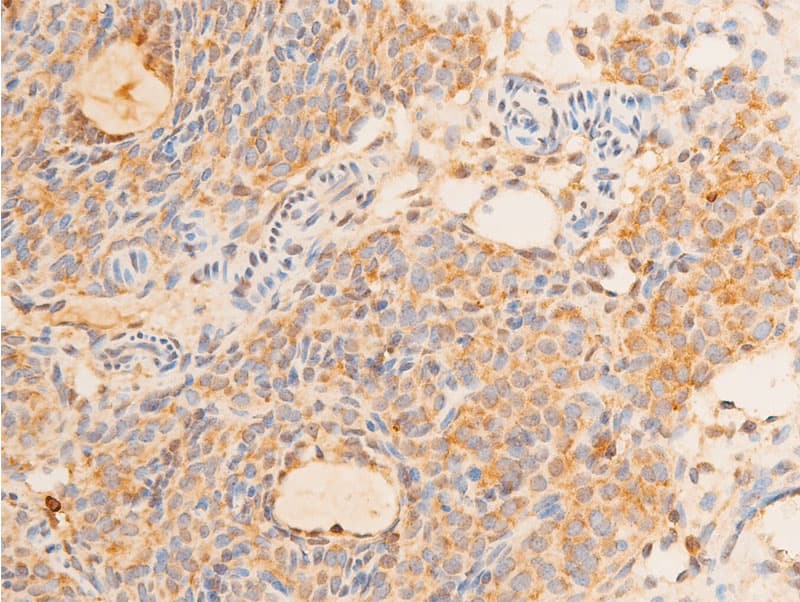 TP73 / p73 Antibody (phospho-Tyr99)