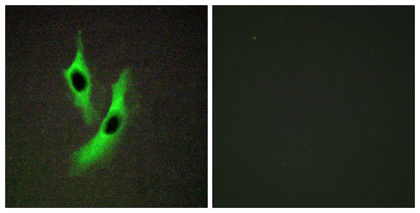 Polyclonal Rabbit anti-Human STEAP4 Antibody (IHC, IF)