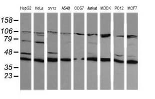 MAP2K1 / MKK1 / MEK1 Antibody (clone OTI3B4, Carrier-free)