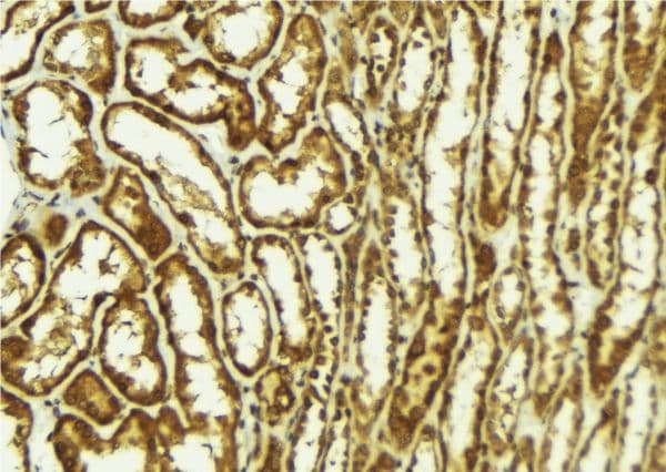 HIPK2 Antibody