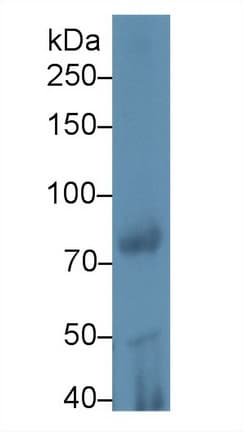 PLA2G6 / IPLA2 Antibody (aa481-702, PE)
