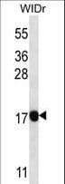 IHC-plus™ PAEP / Glycodelin / GdF Antibody (aa73-101)