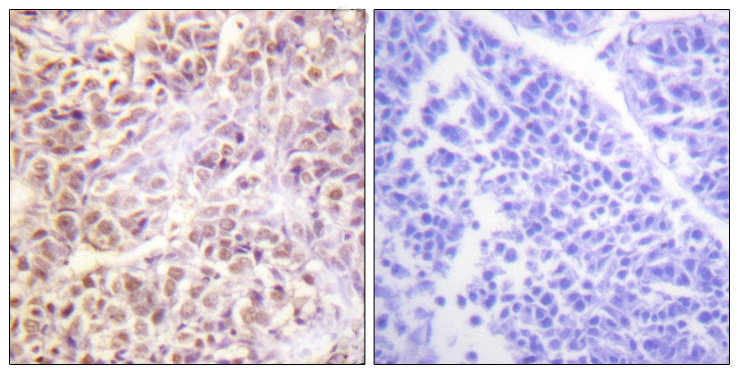 STK4 Antibody (phospho-Thr183)