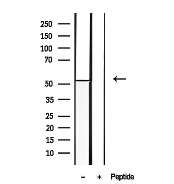 ALDH7A1 Antibody