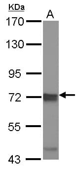 IHC-plus™ Polyclonal Rabbit anti-Human IKBKE / IKKI / IKKE Antibody (IHC, WB)