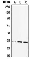 HLA-DQB2 Antibody (Internal)