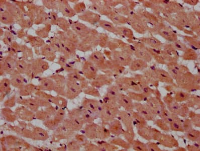 PSME4 / PA200 Antibody