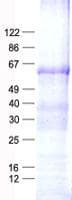 Human PFK2 / PFKFB3 Protein (Recombinant His, N-Terminal)